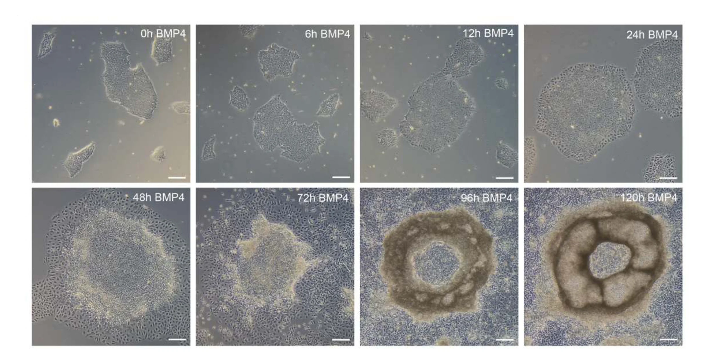 Open access visualization of Microscopy, hESCs, BMP4 Treatment, Cell Culture