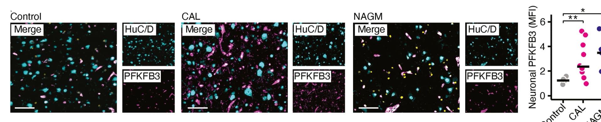 Open access visualization of Microscopy, Scatter Plot, Bar Plot, PFKFB3, Postmortem Cortices