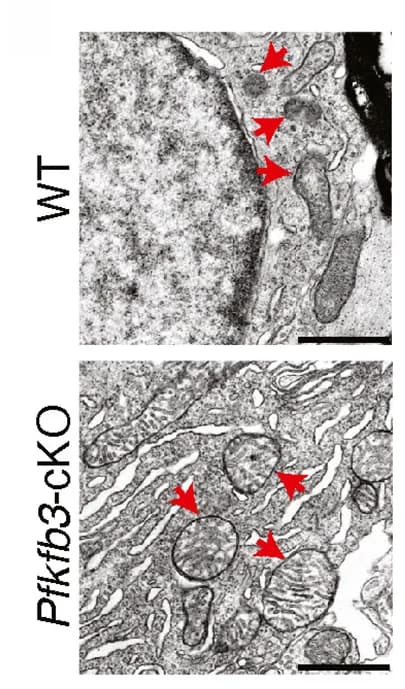 Open access visualization of Microscopy, Transmission Electron Microscopy, Spinal Cord Neurons, WT, Pfkfb3-cKO