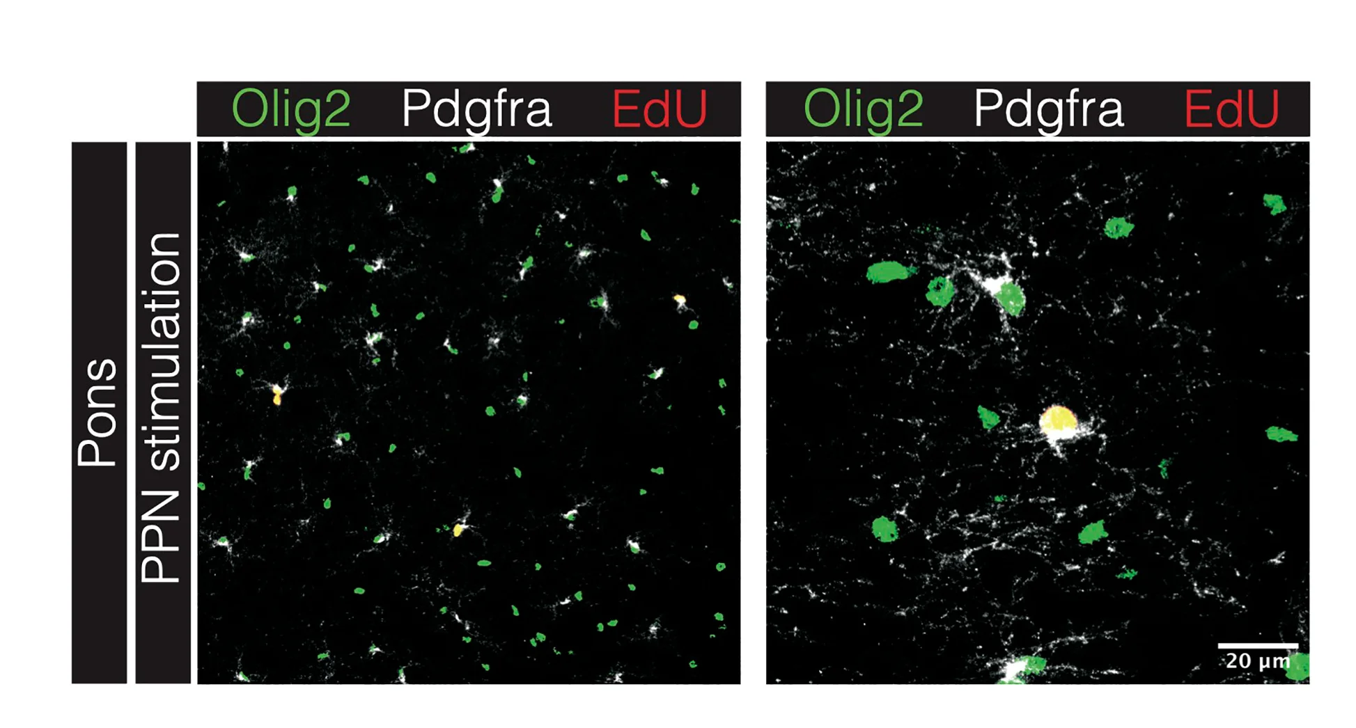 Open access visualization of Microscopy, Confocal Micrographs, Pons, OPC Response, Pedunculopontine Nucleus