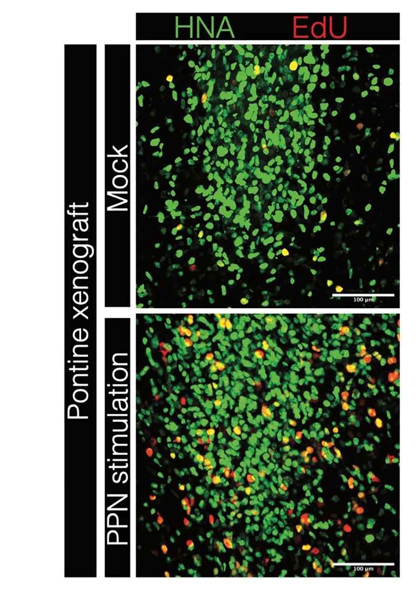 Open access visualization of Microscopy, Confocal Micrographs, HNA Glioma Cells, Mock Stimulation, PPN Stimulation