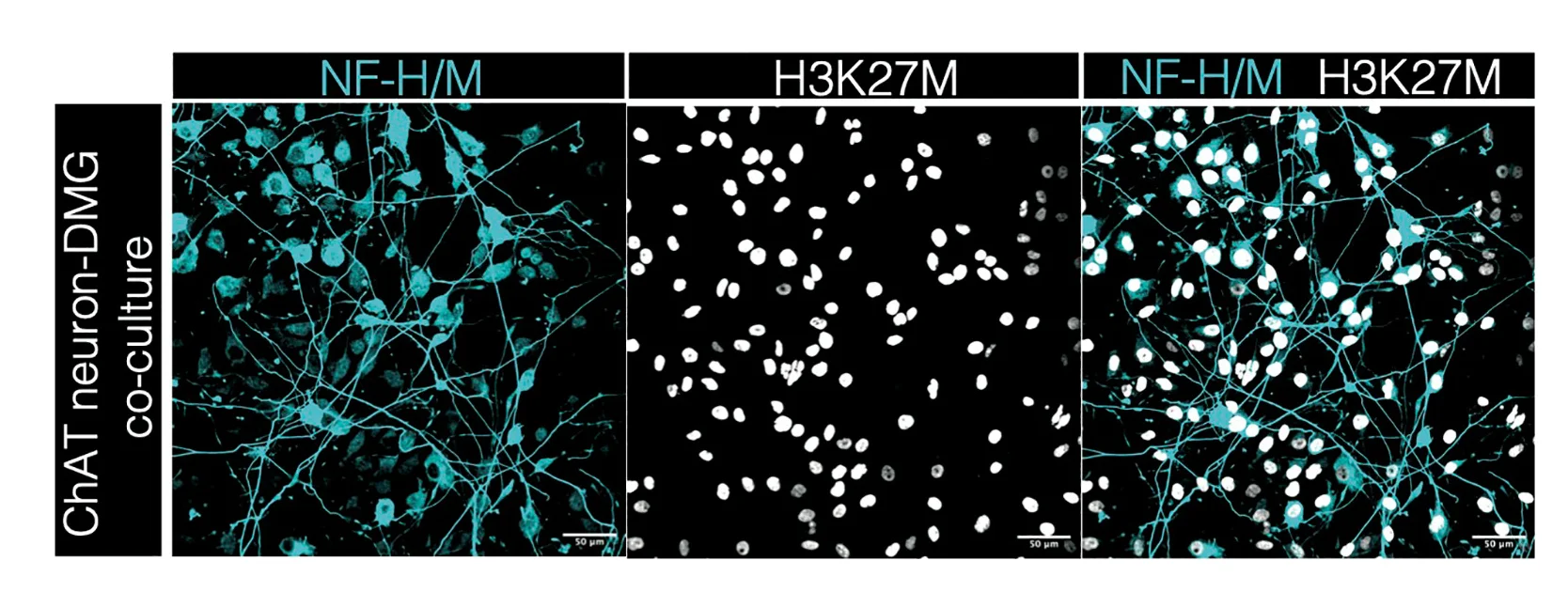 Open access visualization of Microscopy, Confocal Micrographs, Cholinergic Motor Neurons, hiPSCs, DMG Cells