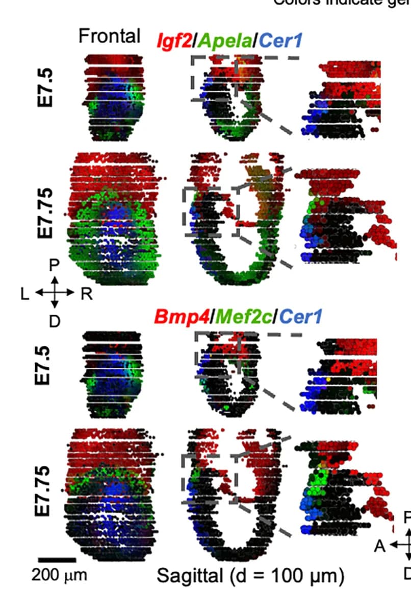 Open access visualization of Scatter Plot, Gene Expression Patterns, PDZ, Frontal Views, Sagittal Sections