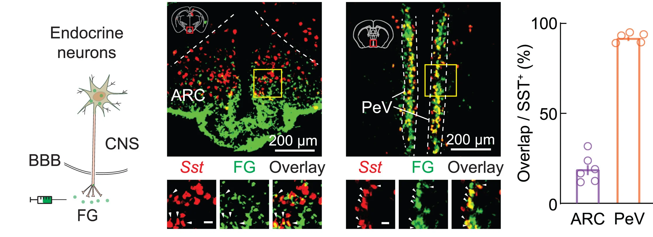 Open access visualization of Bar Plot, Scatter Plot, Microscopy, Illustration, Fluorogold