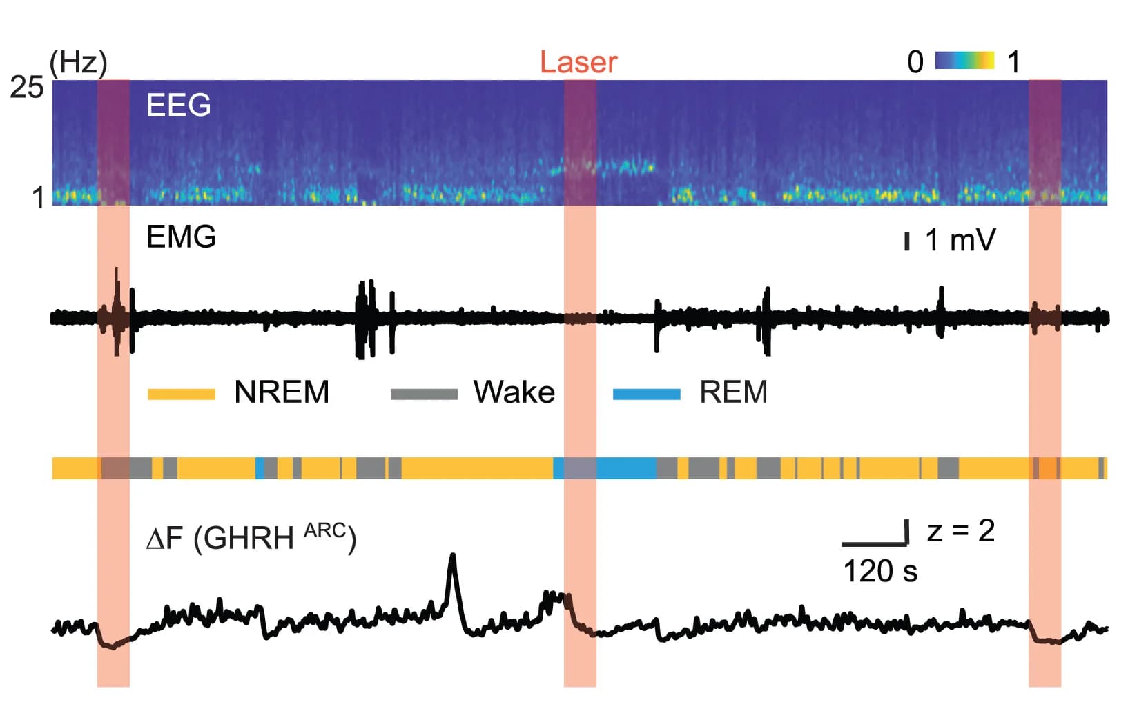Open access visualization of Line Plot, Heatmap, EEG Spectrogram, EMG Trace, Brain States