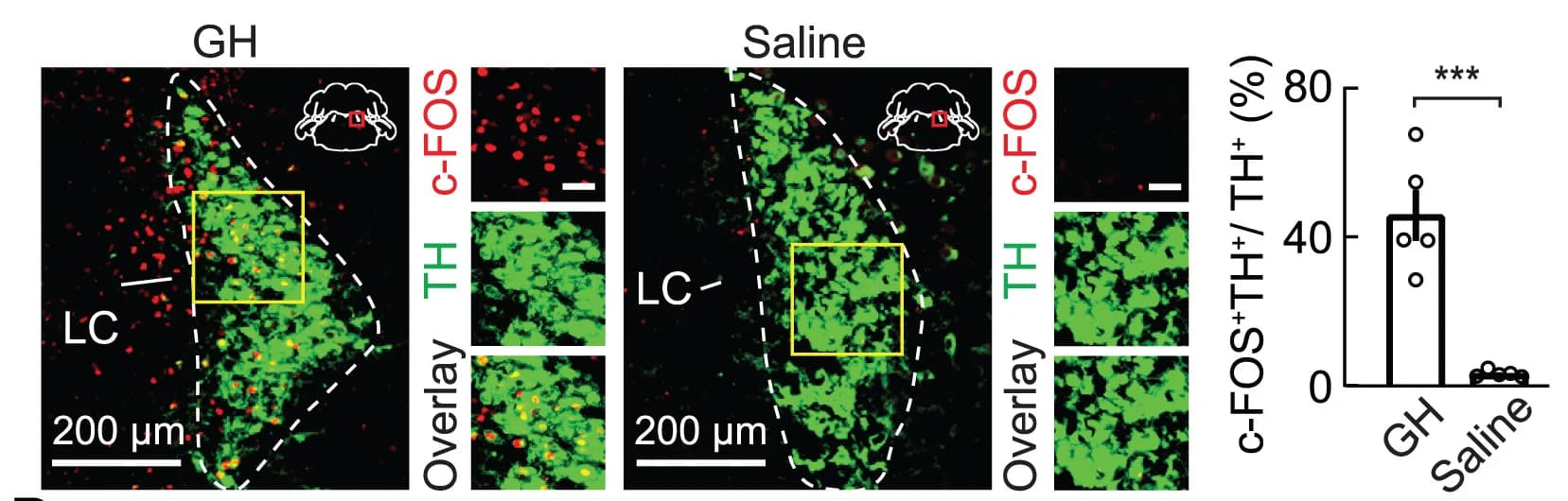 Open access visualization of Bar Plot, Microscopy, TH Protein, c-FOS, Saline