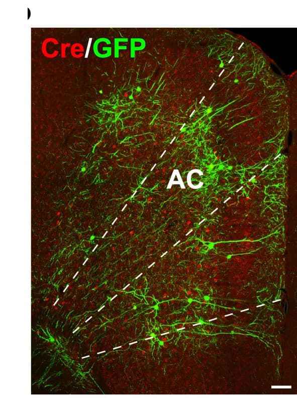 Open access visualization of Microscopy, Immunostaining, GFP, Cre, Prefrontal Cortex