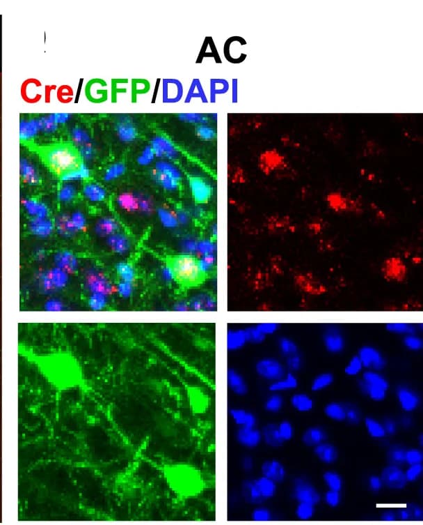 Open access visualization of Microscopy, Immunostaining, Co-localization, Cre, GFP