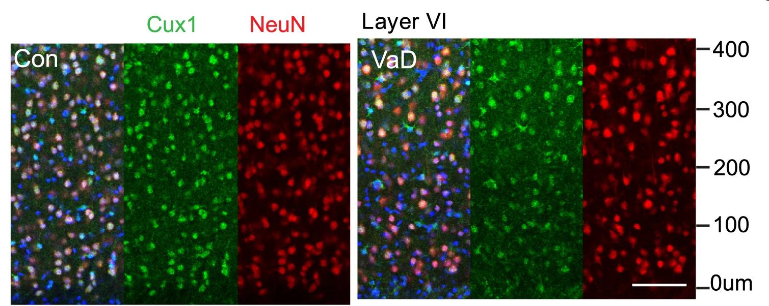 Open access visualization of Microscopy, Immunostaining, Cux1, NeuN, DAPI