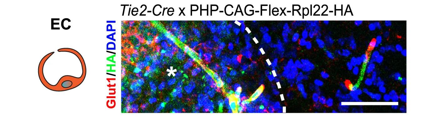Open access visualization of Microscopy, Illustration, Immunostaining, Endothelial Cells, Pericyte
