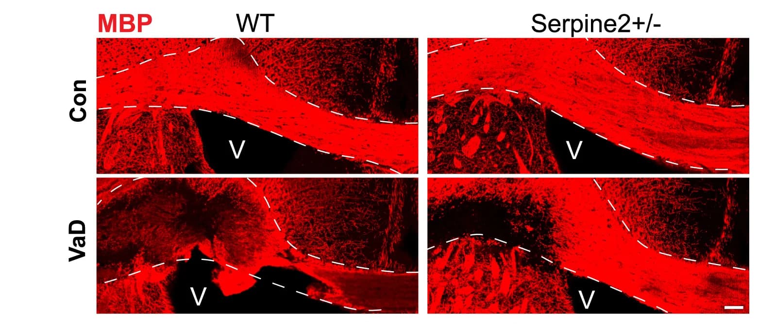 Open access visualization of Microscopy, Immunostaining, MBP, Wild-Type Animals, Serpine2 Animals