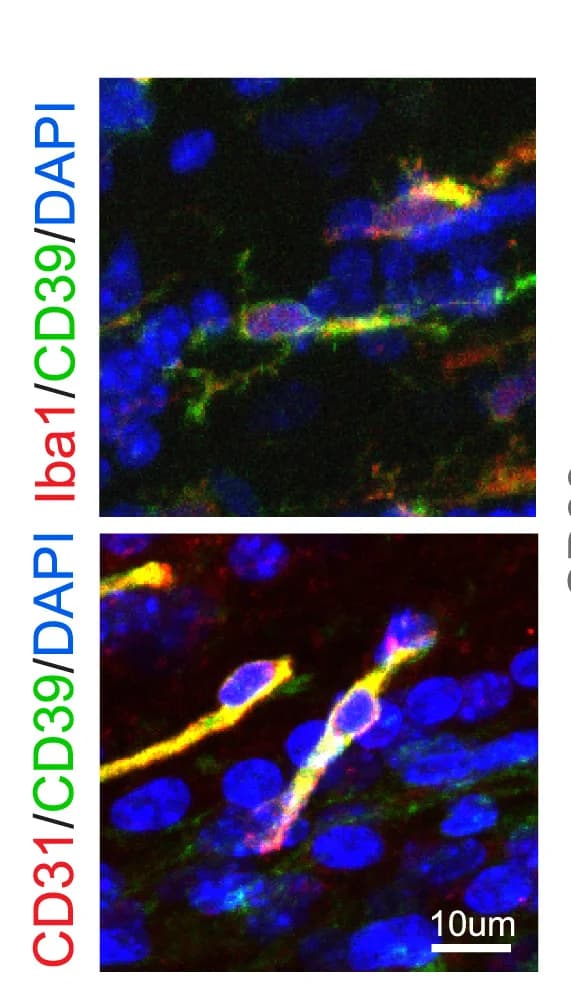 Open access visualization of Microscopy, Immunostaining, CD39, Microglia, Iba1