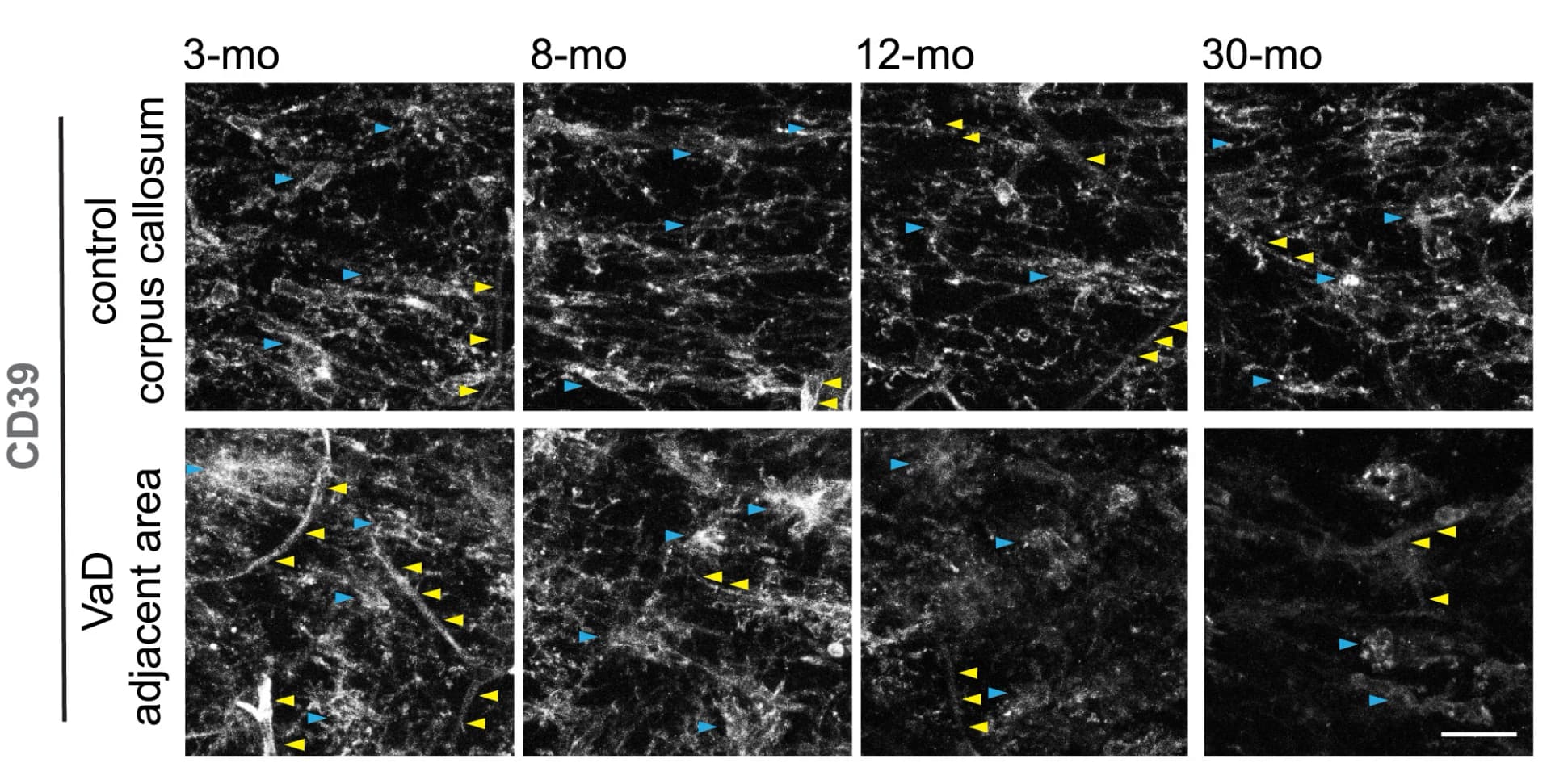 Open access visualization of Microscopy, CD39, Immunoreactivity, Microglia, EC