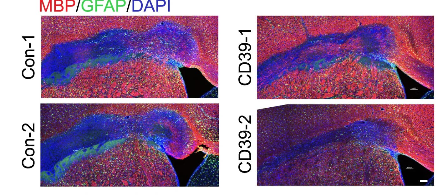 Open access visualization of Microscopy, Immunostaining, VaD, Lesion Size, MBP