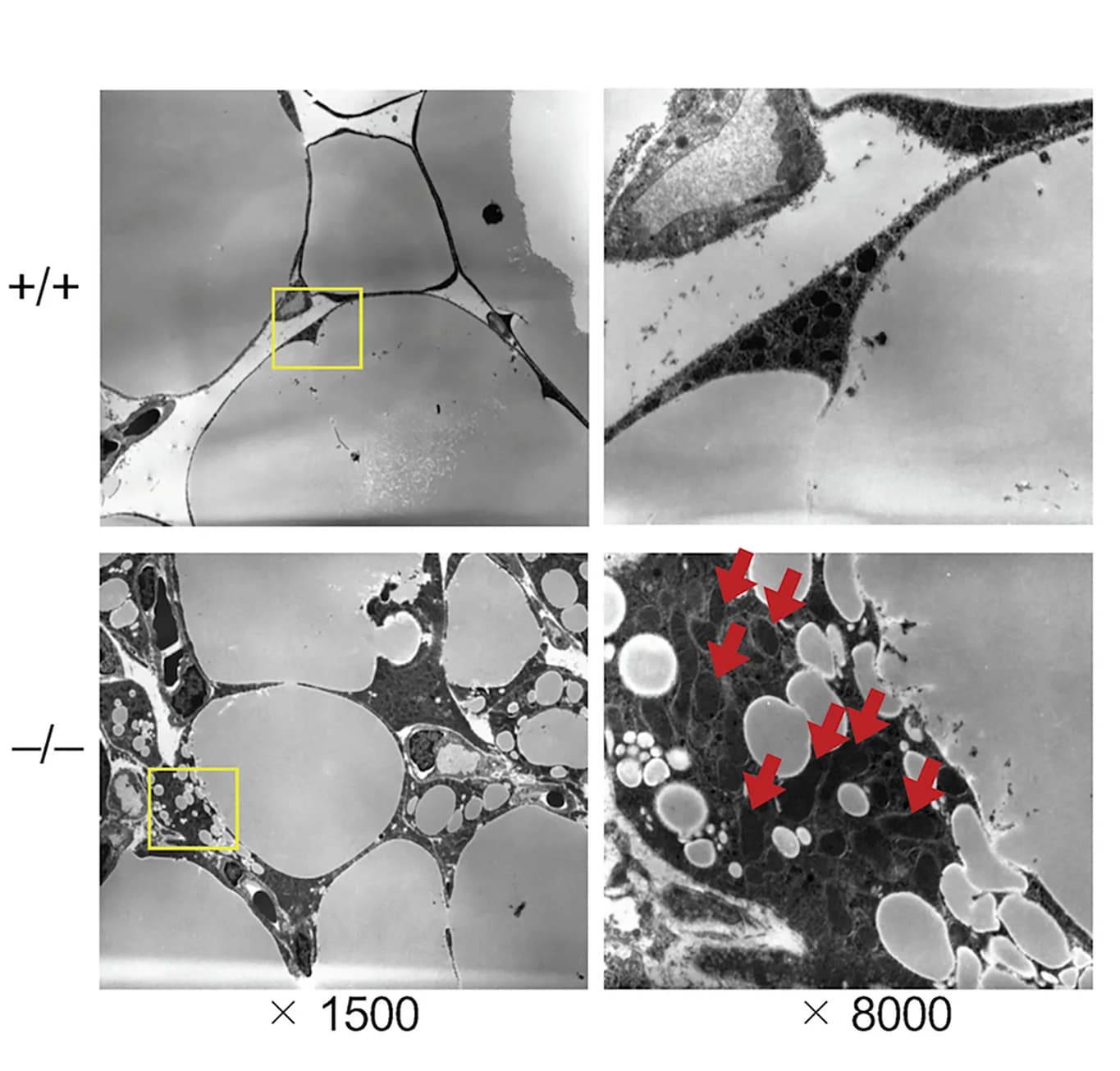 Open access visualization of Microscopy, Transmission Electron Microscopy, WAT, Pnpla7+/+ Mice, Pnpla7-/- Mice