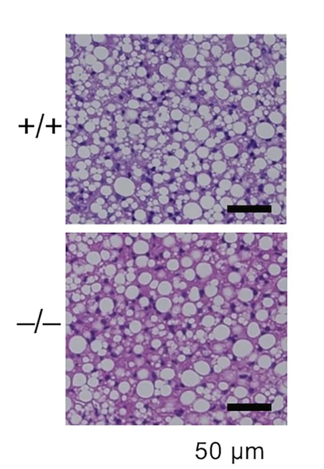 Open access visualization of Microscopy, Histology, Pnpla7+/+ Mice, Pnpla7-/- Mice, BAT