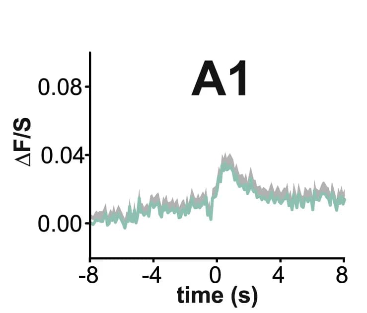 Open access visualization of Line Plot, Error Bars, EGFP-PH-PLCd1, Time Course, K+ Stimulation