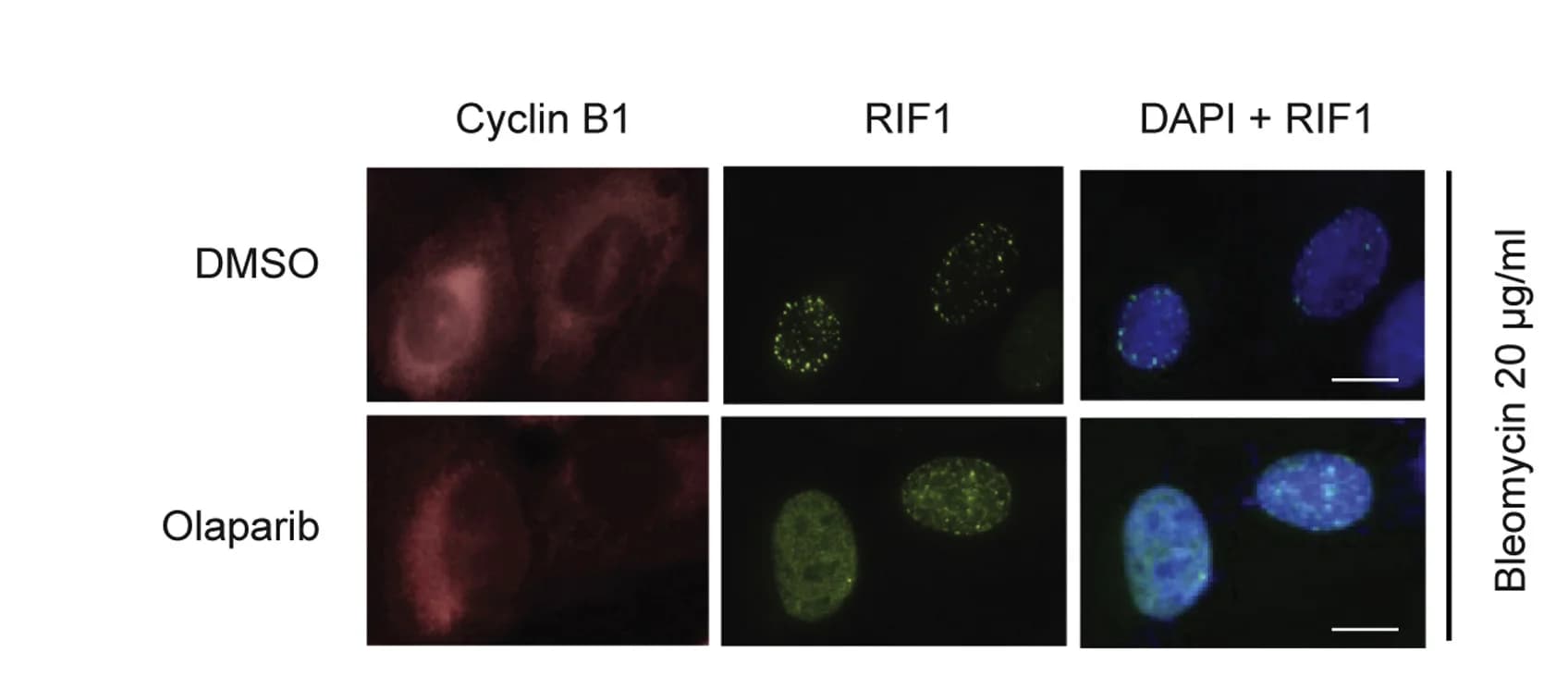 Open access visualization of Microscopy, U-2OS Cells, Bleomycin, DMSO, Immunofluorescence Microscopy