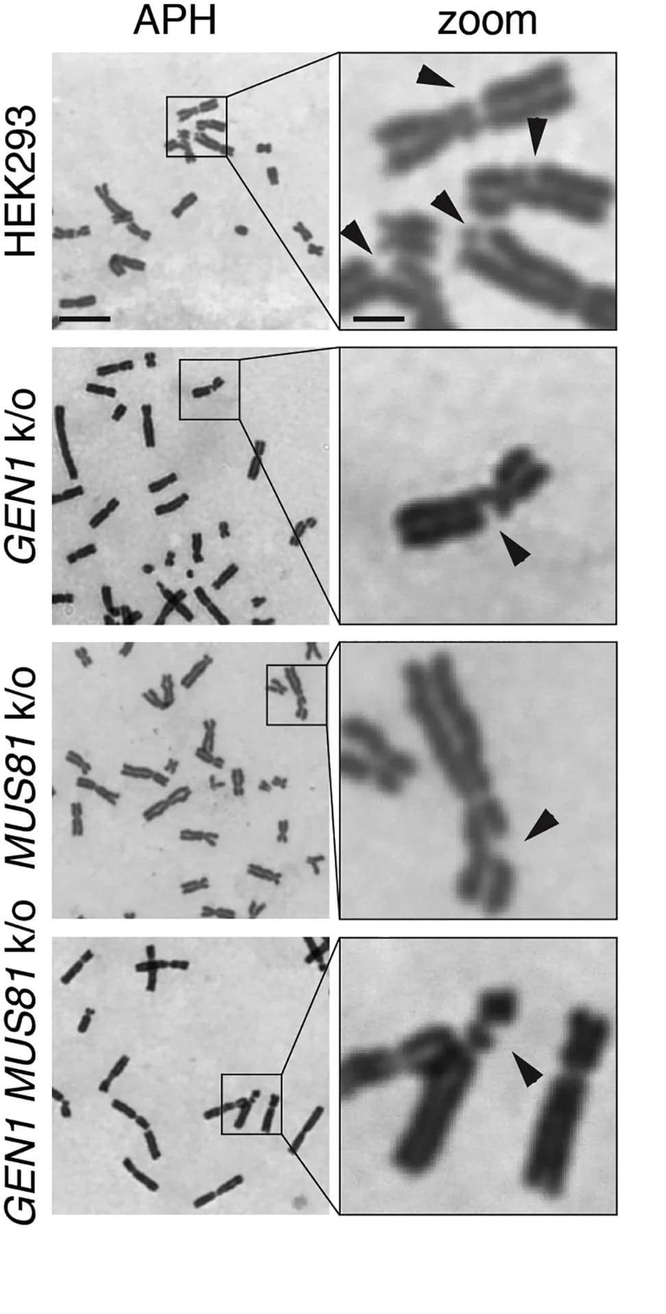 Open access visualization of Microscopy, Giemsa-stained metaphase spreads, HEK293 Cells, GEN1KO Cells, MUS81KO Cells