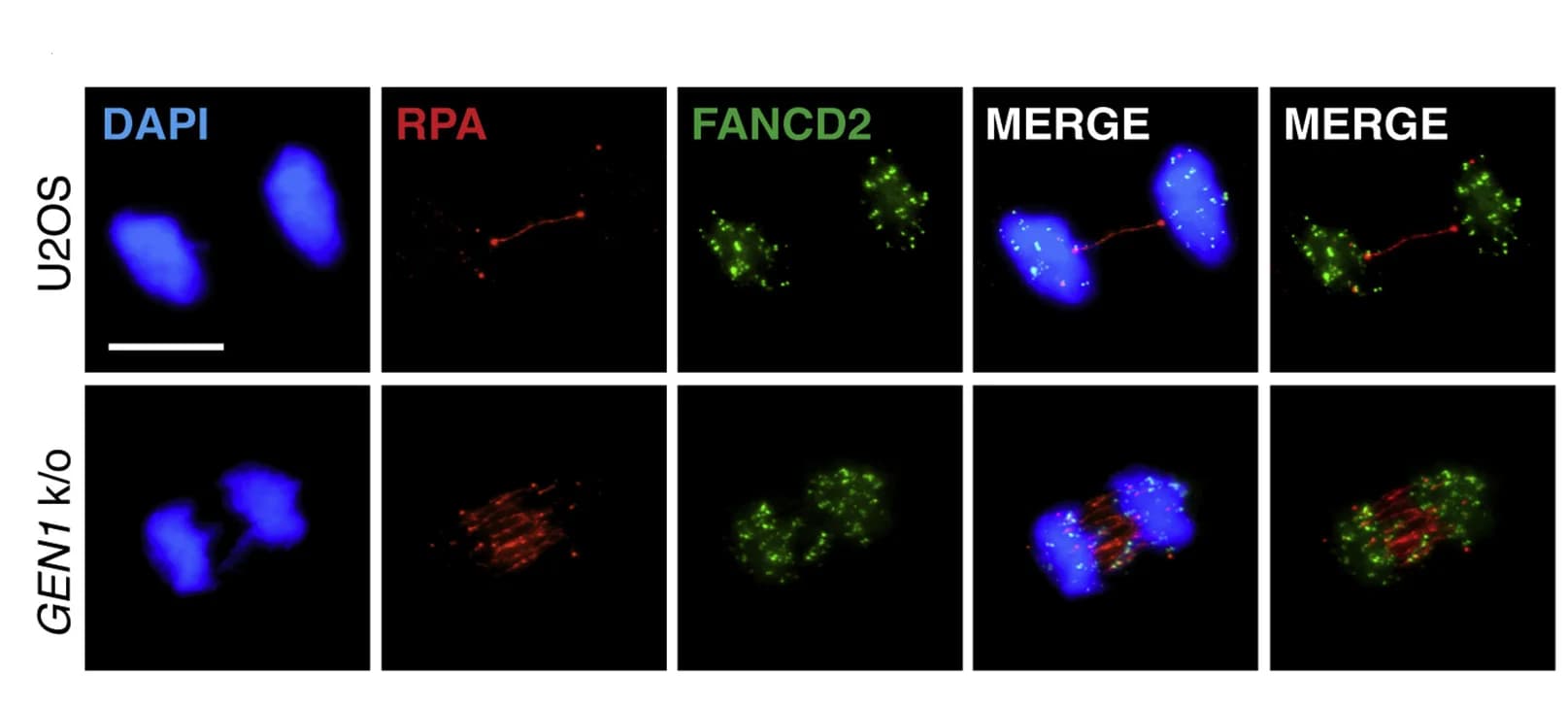Open access visualization of Microscopy, U2OS Cells, GEN1KO Cells, APH Treatment, Anaphase Cells