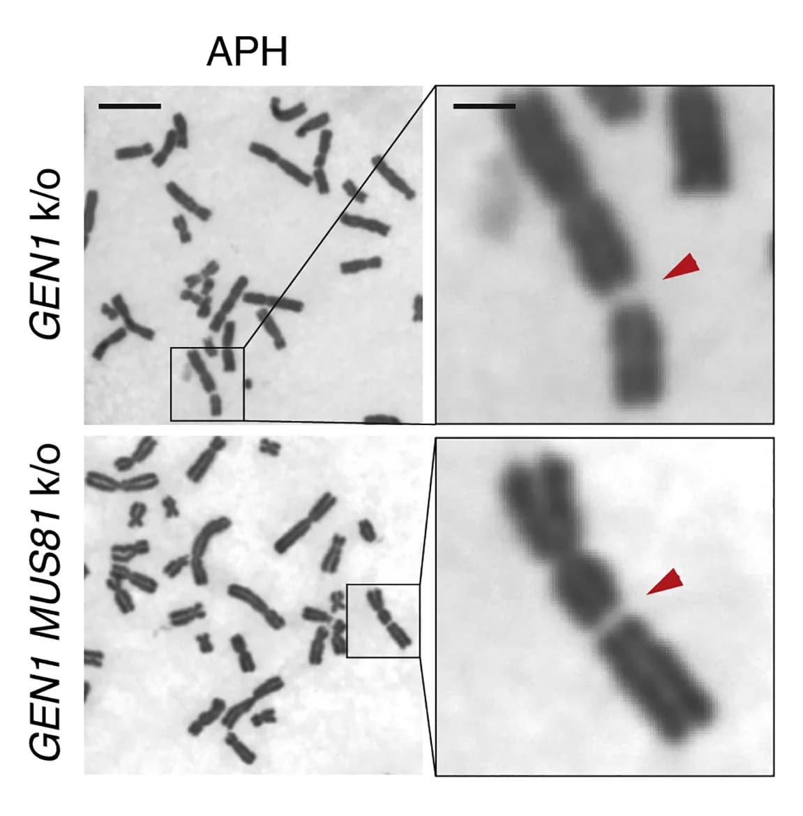 Open access visualization of Microscopy, Giemsa-stained Metaphase Chromosome, GEN1KO Cells, GEN1 MUS81KO Cells, Aphidicolin