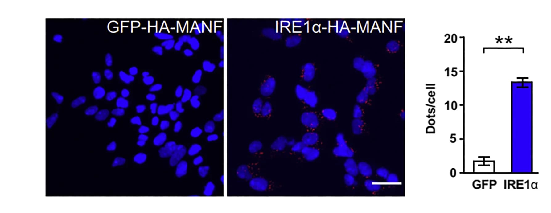 Open access visualization of Bar Plot, Error Bars, Proximity Ligation Assay, MANF-IRE1alpha-HA Interaction, GFP-HA