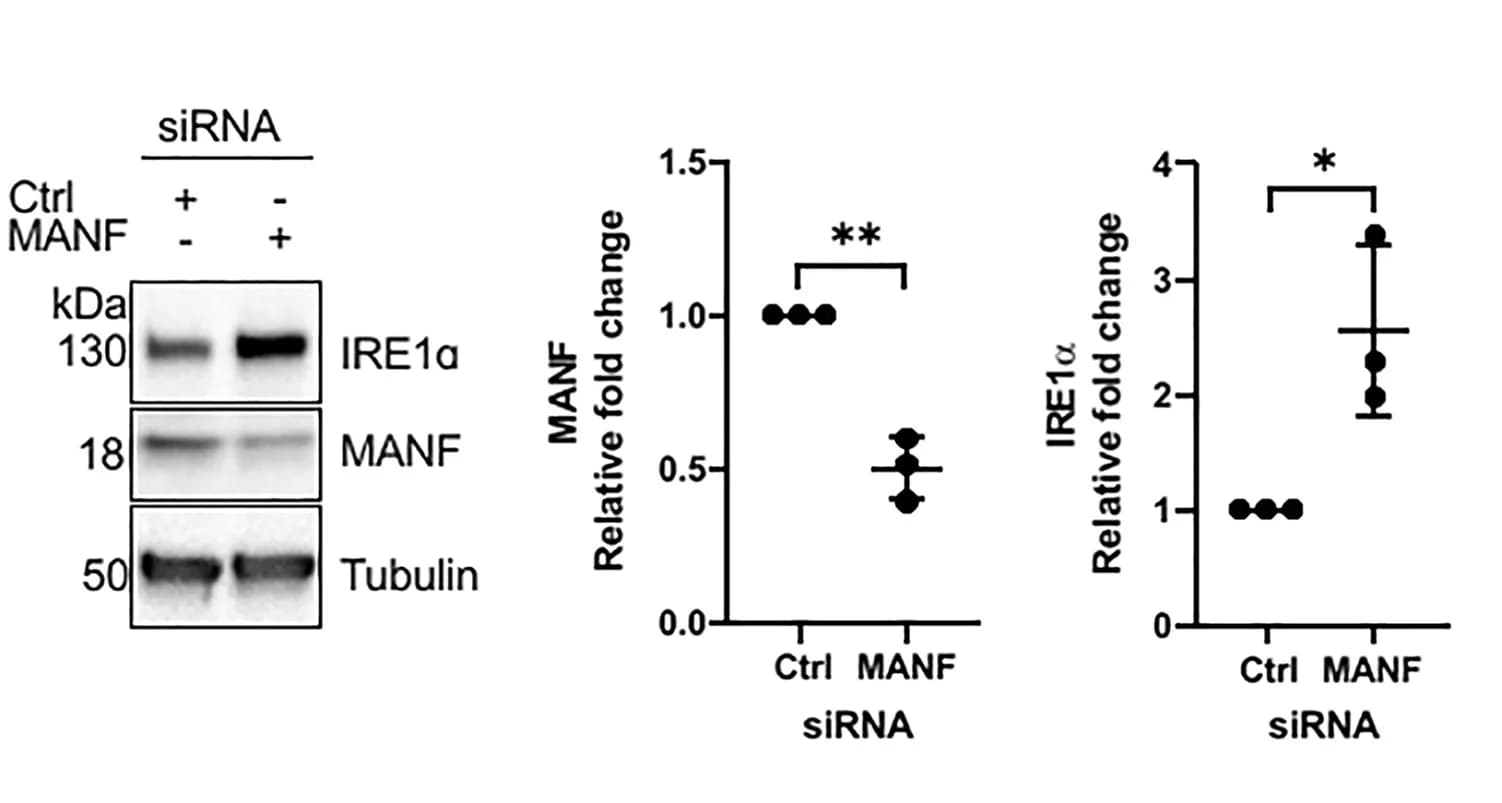 Open access visualization of Scatter Plot, Error Bars, Gel, MANF, IRE1alpha