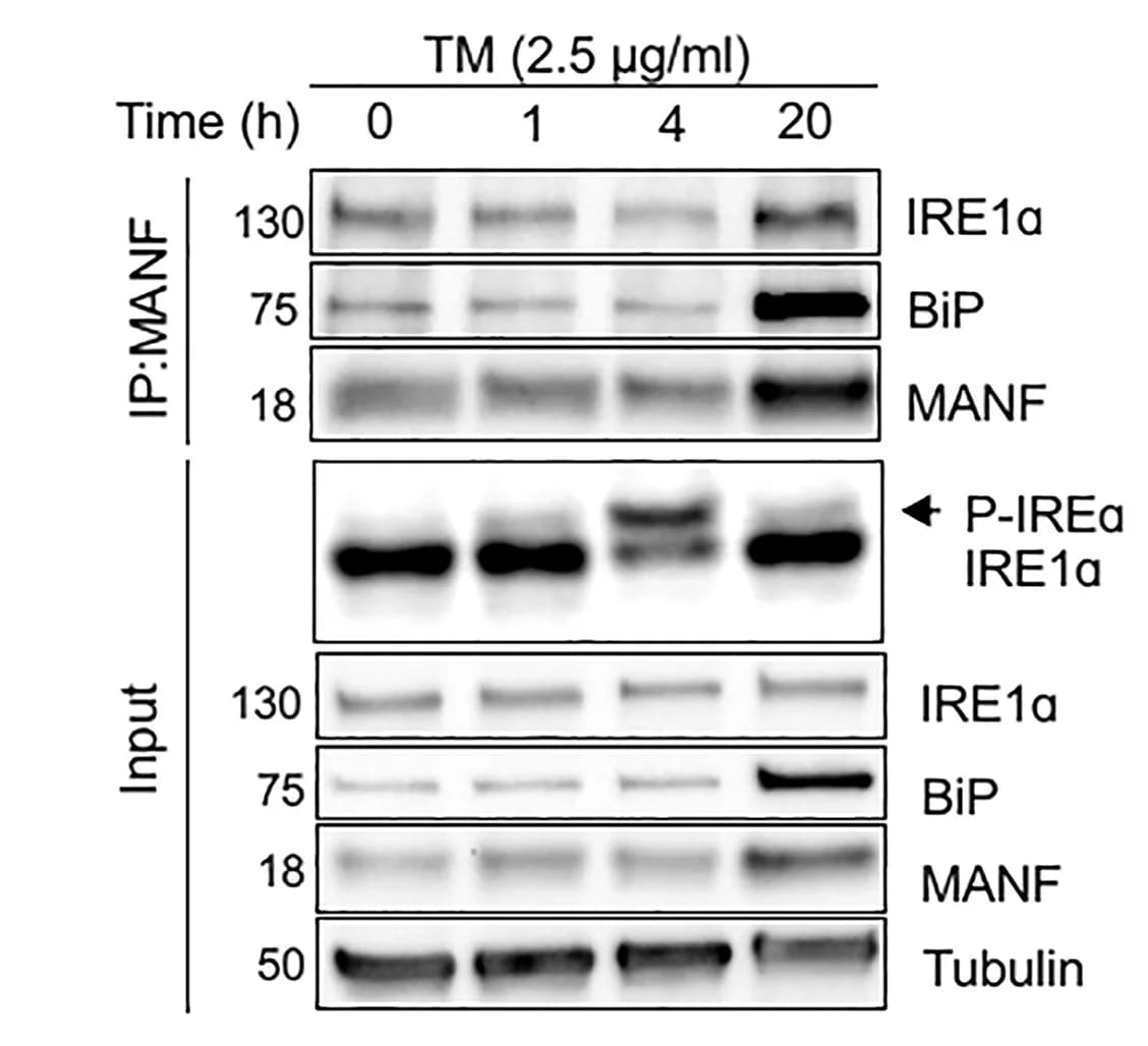 Open access visualization of Gel, IRE1alpha, BiP, MANF, Immunocomplex