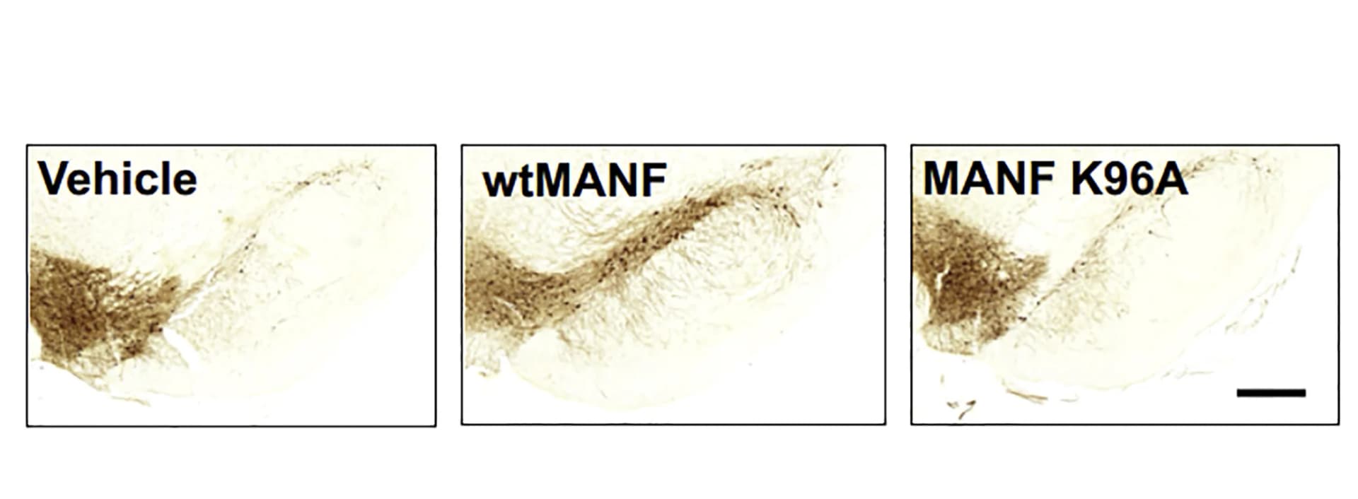 Open access visualization of Microscopy, Substantia Nigra Pars Compacta, SNpc, Vehicle, wtMANF
