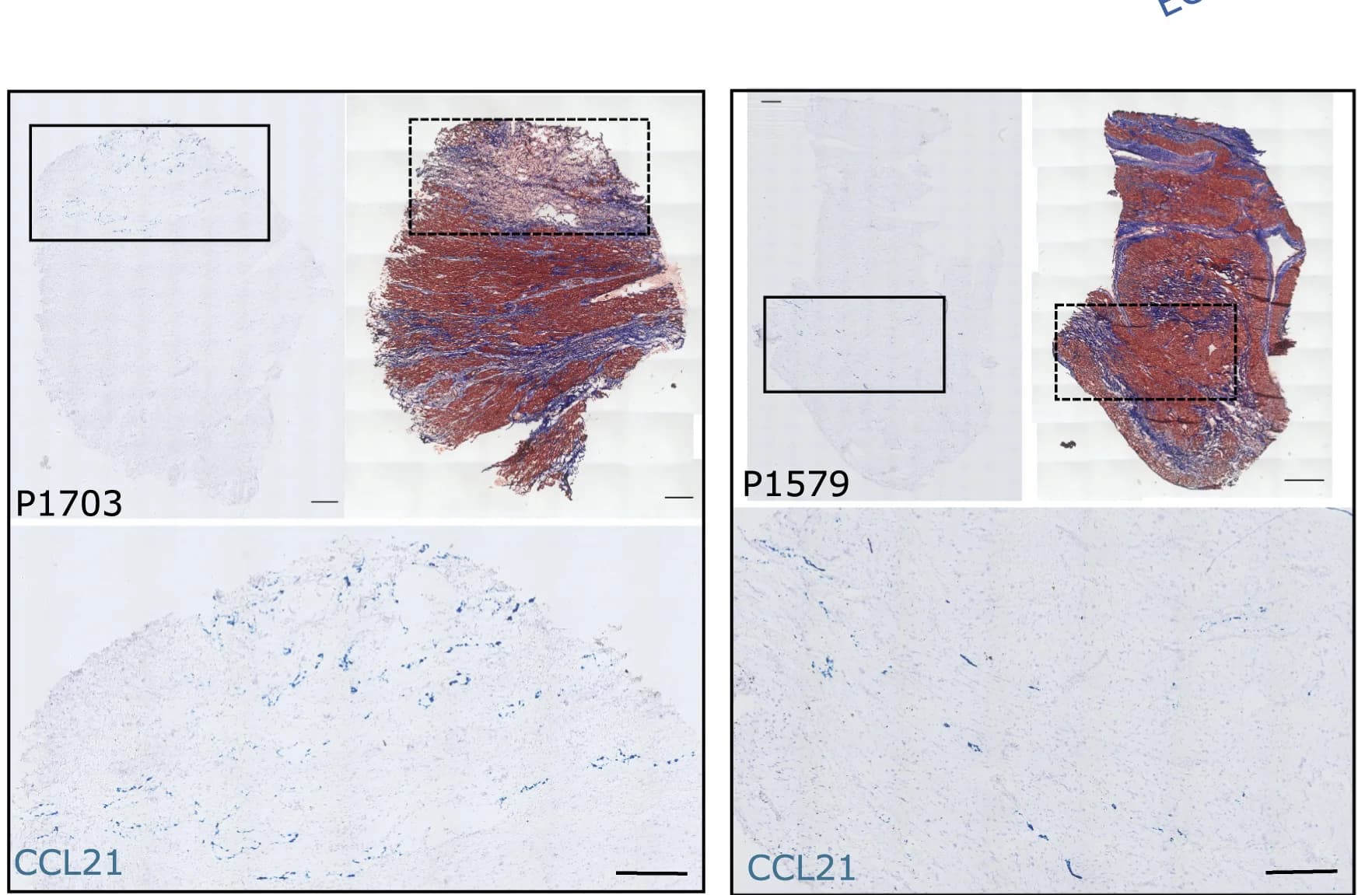 Open access visualization of Microscopy, In Situ Hybridization, EC-lymphatic Cells, CCL21, Trichrome Staining