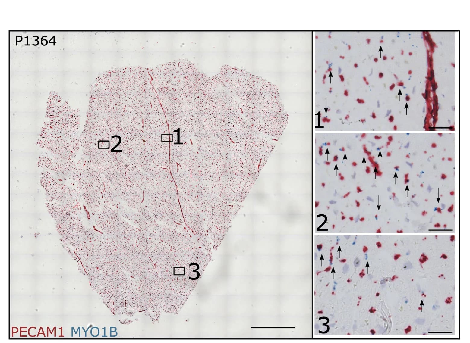 Open access visualization of Microscopy, In Situ Hybridization, EC-angiogenic Cells, PECAM1, MYO1B
