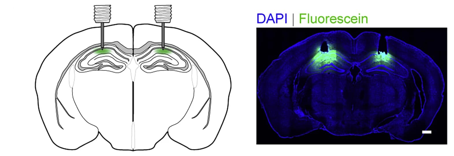 Open access visualization of Microscopy, Illustration, Schematics, Coronal Brain Sections, Cannula Tracks