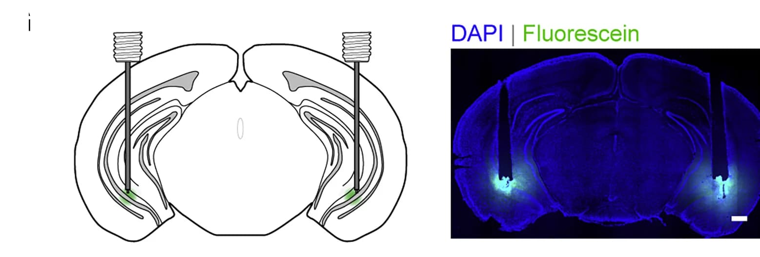 Open access visualization of Microscopy, Illustration, Schematics, Coronal Brain Sections, Cannula Tracks