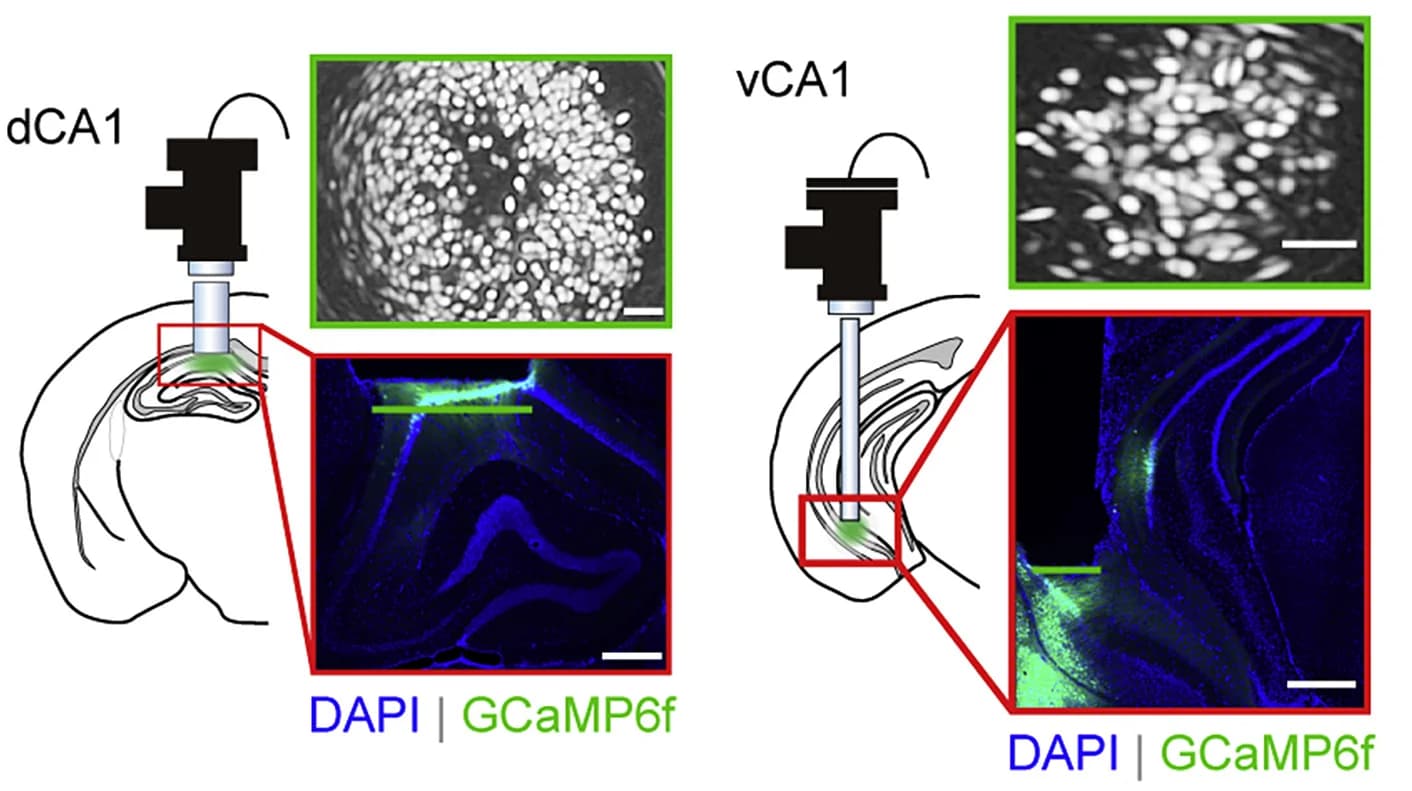 Open access visualization of Microscopy, Illustration, Calcium Imaging, Coronal Brain Sections, DAPI Staining