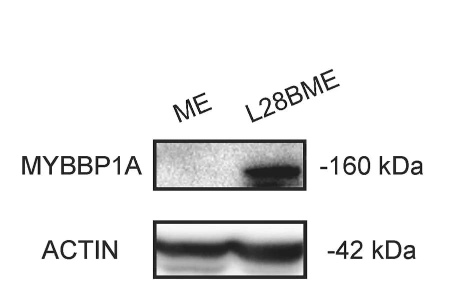 Open access visualization of Gel, Western blot, MYBBP1A, LIN28B