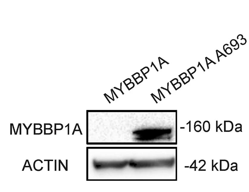 Open access visualization of Gel, Western Blot, MYBBP1A, WT, P693A Mutant