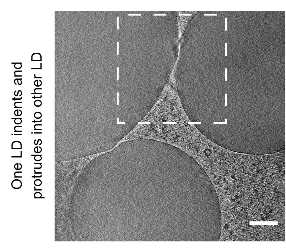 Open access visualization of Microscopy, HeLa Cells, Cidec, Lipid Droplets, Cryo-FM