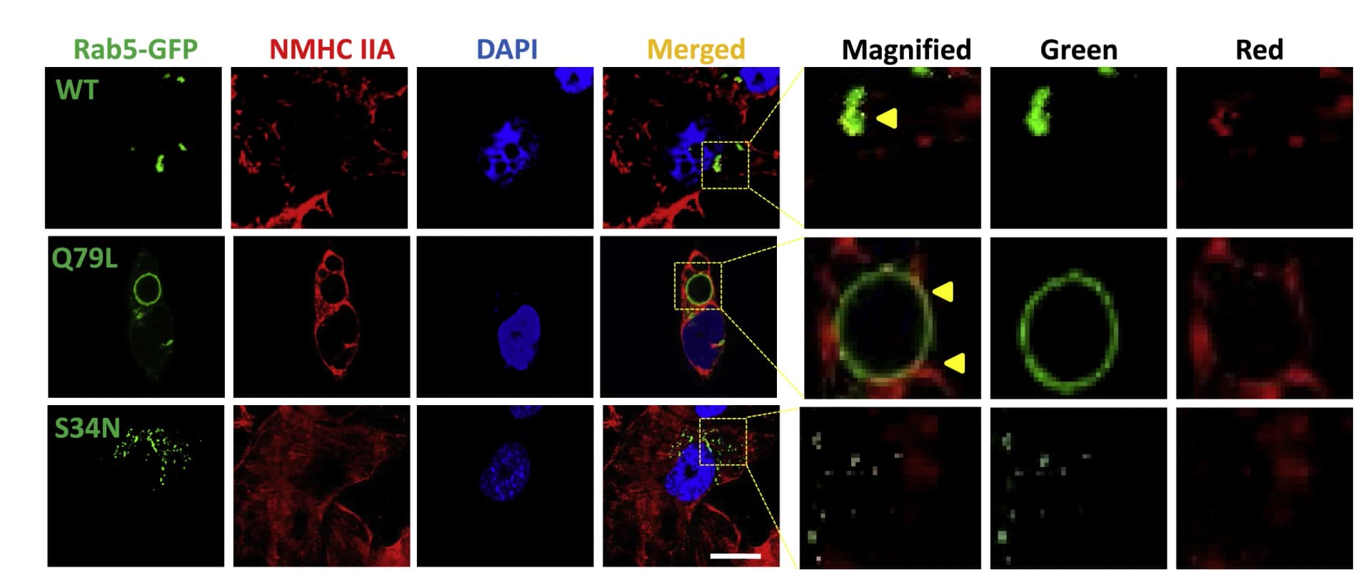 Open access visualization of Microscopy, Transfection, Rab5-GFP, Immunostaining, NMHC IIA