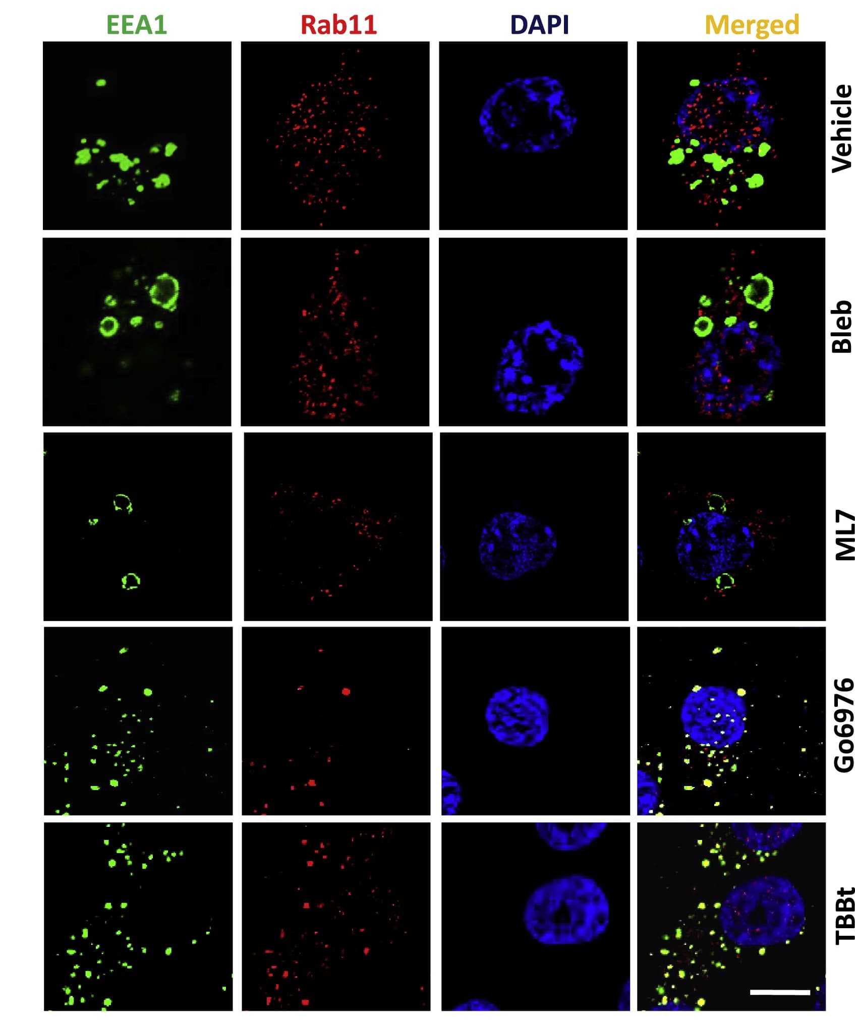 Open access visualization of Microscopy, MDA-MB 231 Cells, DMSO, EEA1, Rab11