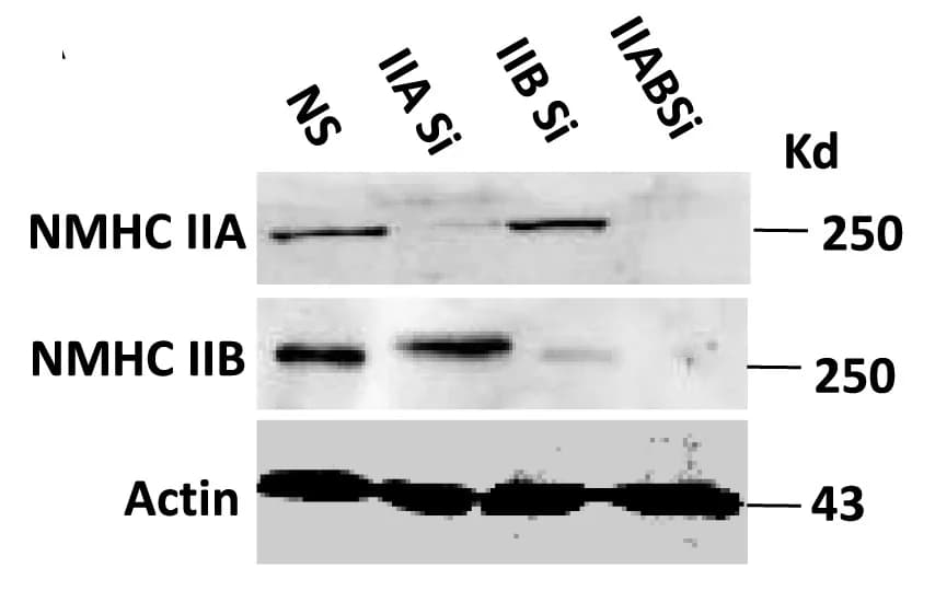 Open access visualization of Gel, Immunoblot, NMHC IIA, NMHC IIB, MDA-MB 231 Cells