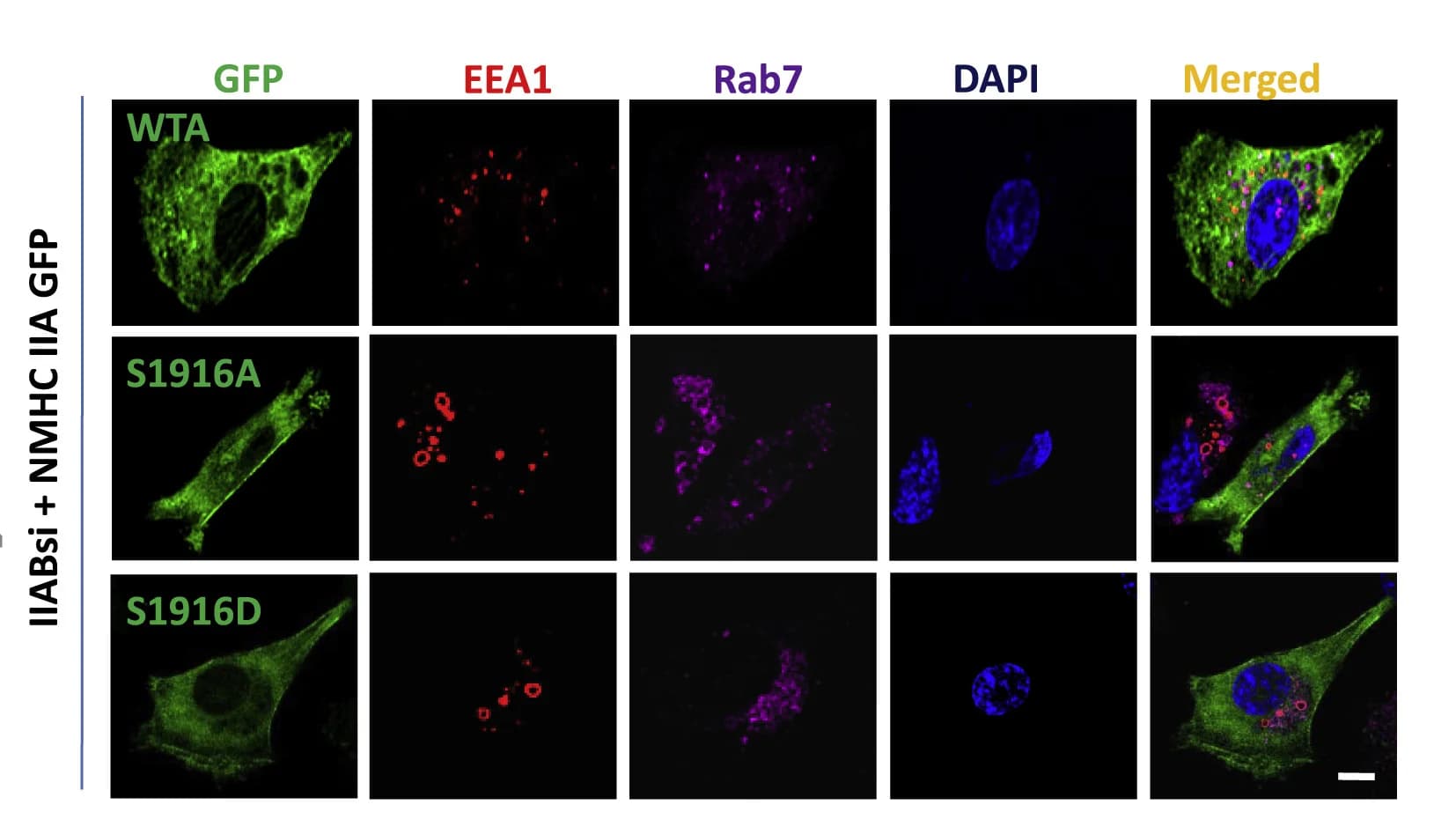 Open access visualization of Microscopy, MDA-MB 231 Cells, IIABsi, Plasmid DNA, GFP-tagged WT NMHC IIA