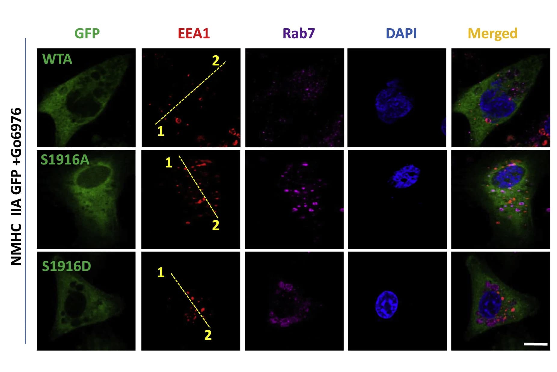 Open access visualization of Microscopy, MDA-MB 231 Cells, GFP-WT NMHC IIA, NMHC IIA S1916A, NMHC IIA S1916D
