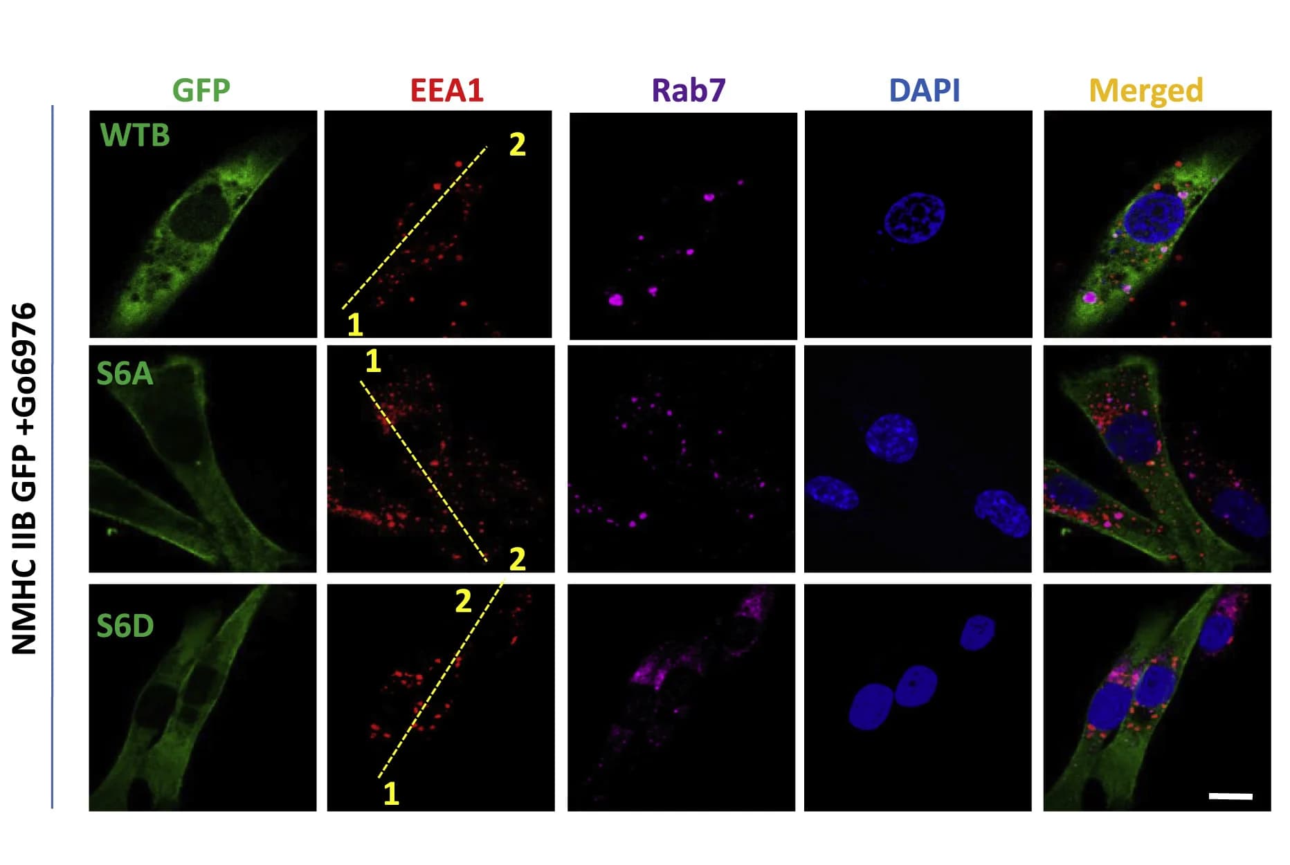 Open access visualization of Microscopy, MDA-MB 231 Cells, GFP-WT NMHC IIB, NMHC IIB S6A, NMHC IIB S6D