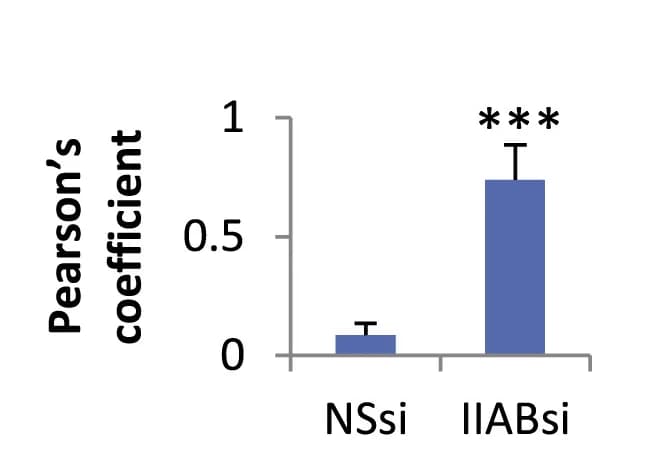 Open access visualization of Bar Plot, Error Bars, Quantification, Pc