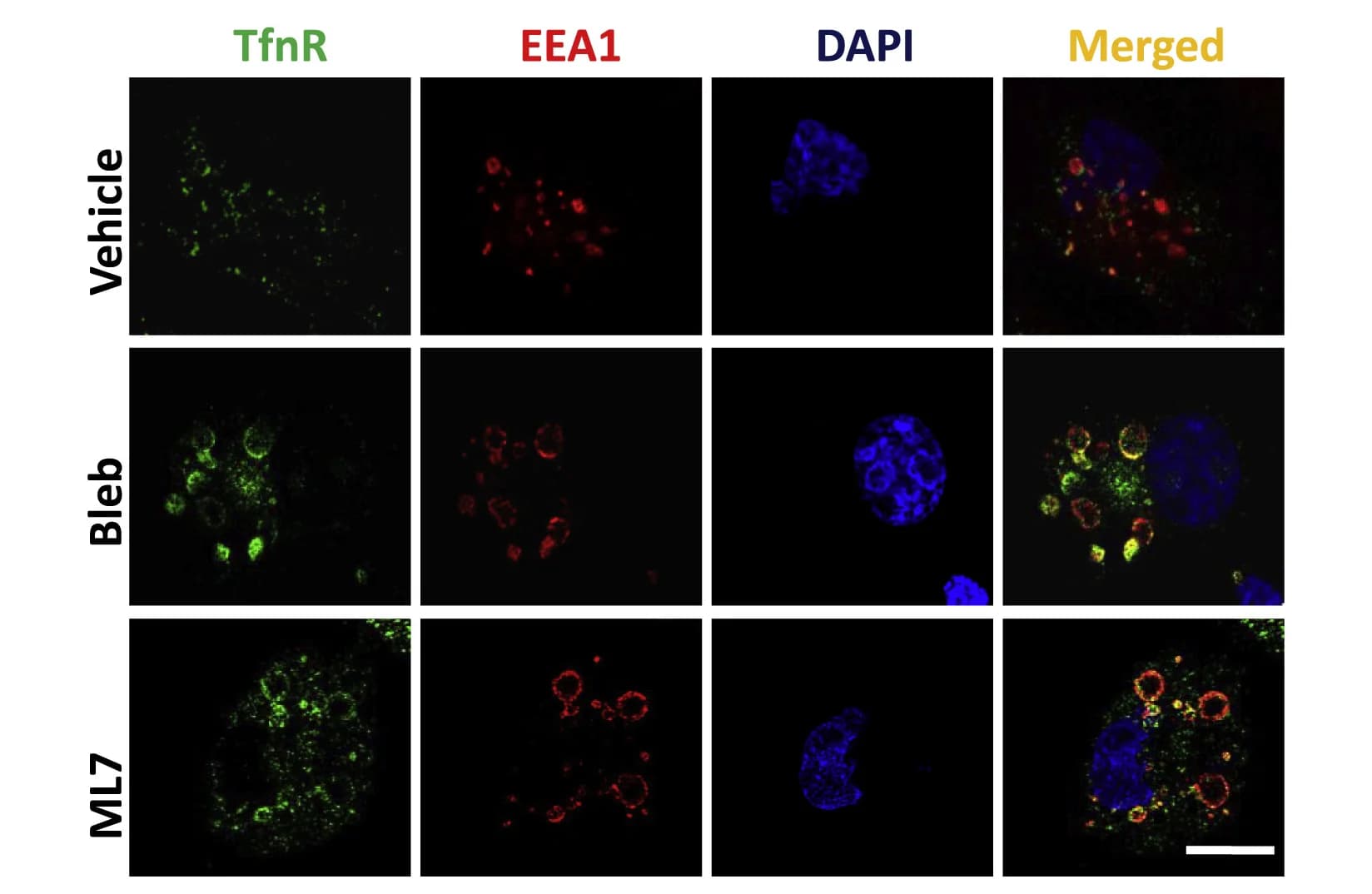 Open access visualization of Microscopy, TfnR, MDA-MB 231 Cells, Vehicle, Bleb