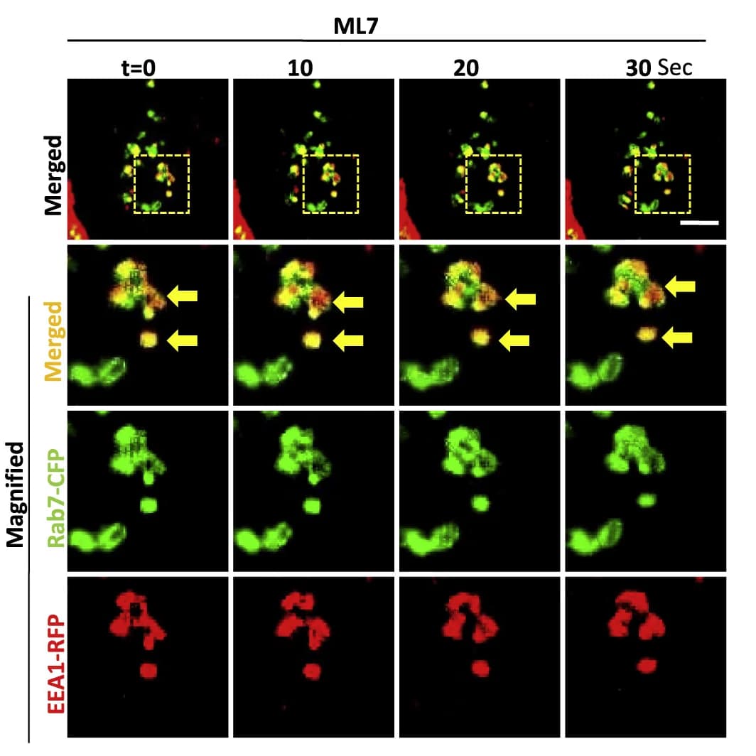 Open access visualization of Microscopy, MDA-MB 231 cells, EEA1-RFP, Rab7-CFP, ML7