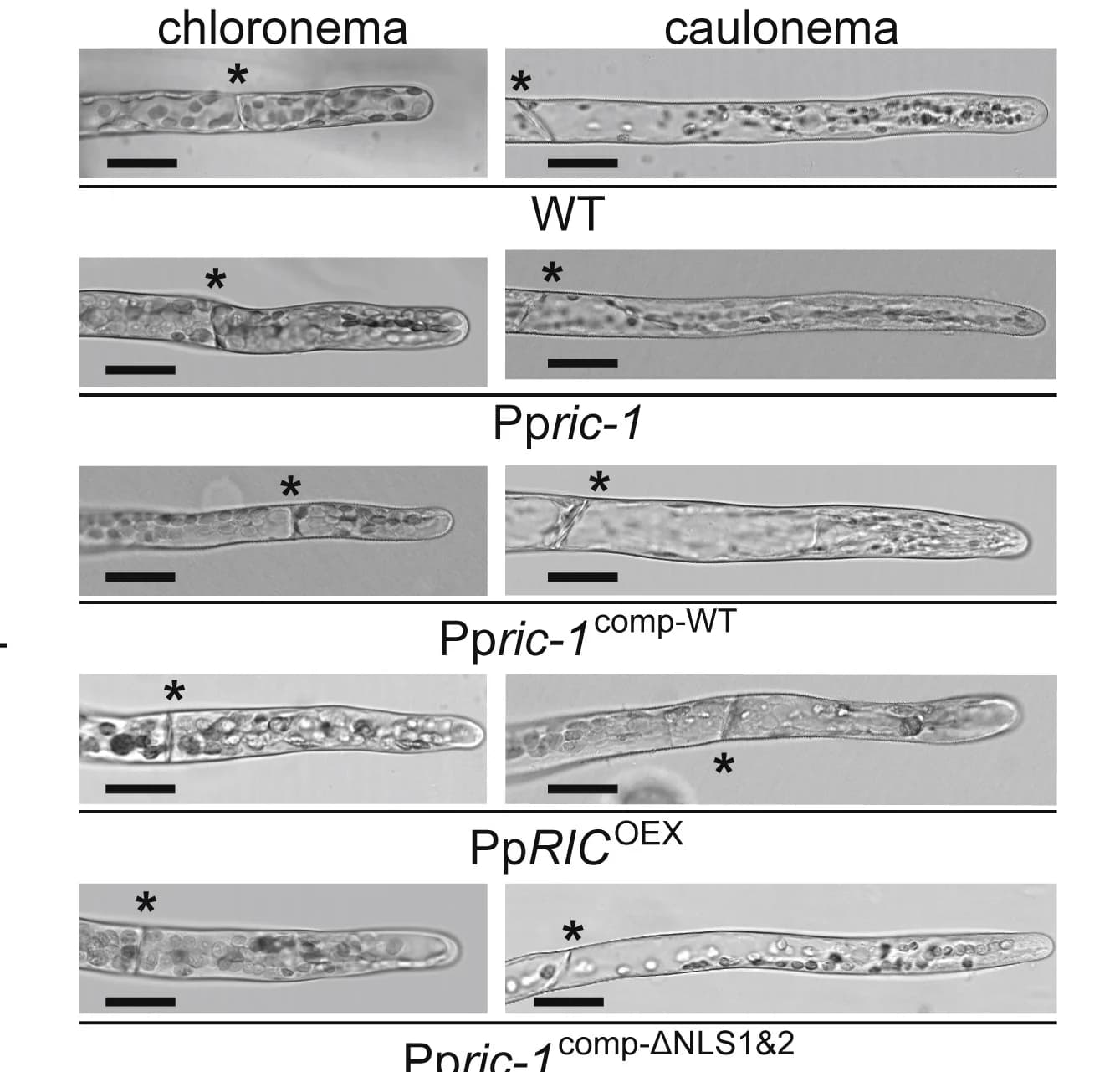 Open access visualization of Microscopy, Bright-Field Micrographs, Protonemal Filaments, Genotype, Cell Wall