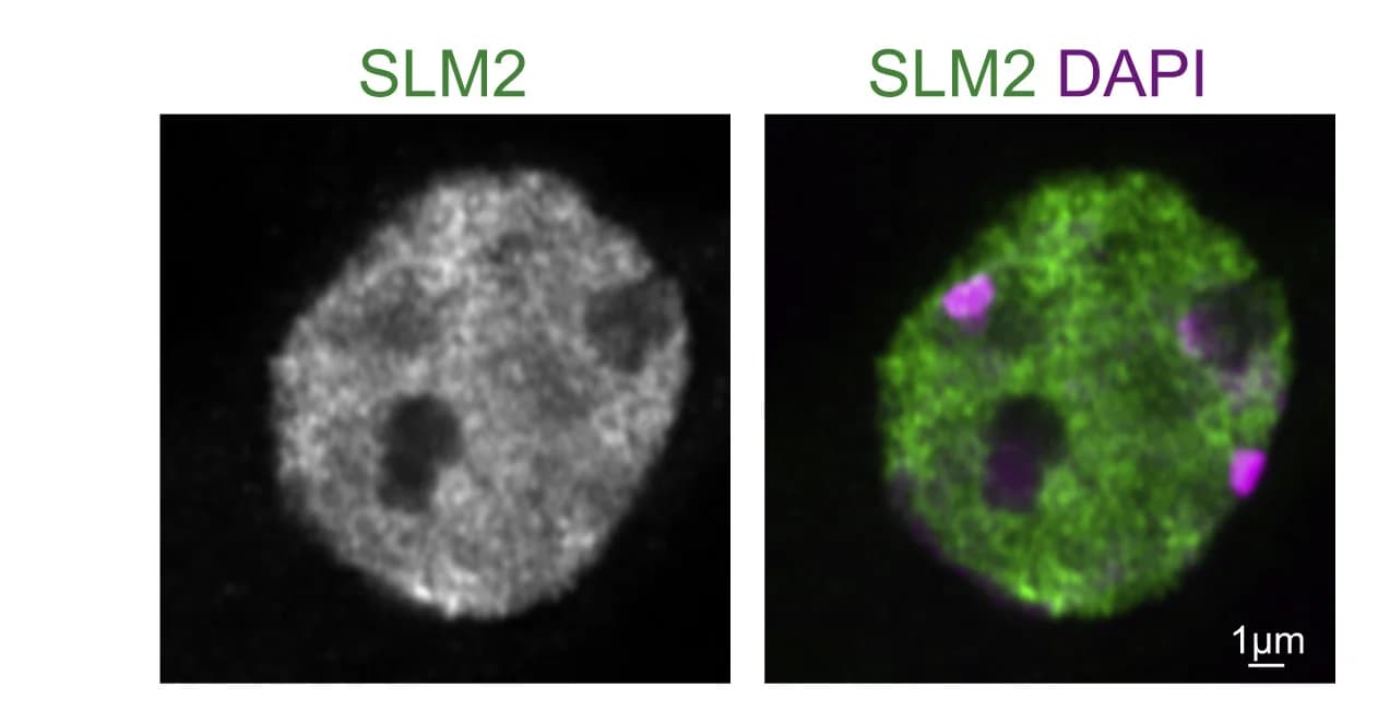 Open access visualization of Microscopy, SLM2 immunoreactivity, DAPI, Hippocampus
