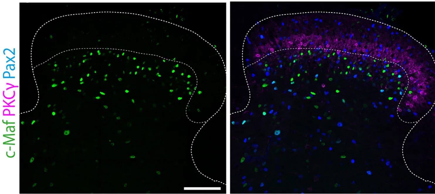 Open access visualization of Microscopy, c-Maf, Dorsal Spinal Cord, c-MafCre allele