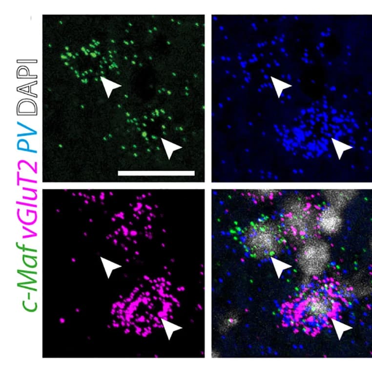 Open access visualization of Microscopy, In Situ Hybridization, c-Maf, VGlut2, PV